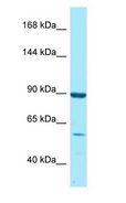 RGL1 / RGL Antibody - RGL1 / RGL antibody Western Blot of Fetal Heart.  This image was taken for the unconjugated form of this product. Other forms have not been tested.