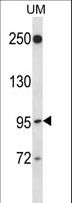 RGL2 Antibody - RGL2 Antibody western blot of uterine tumor cell line lysates (35 ug/lane). The RGL2 antibody detected the RGL2 protein (arrow).