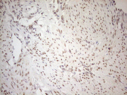 RGL2 Antibody - Immunohistochemical staining of paraffin-embedded Human endometrium tissue using anti-RGL2 mouse monoclonal antibody. (Heat-induced epitope retrieval by 1mM EDTA in 10mM Tris buffer. (pH8.5) at 120°C for 3 min. (1:150)