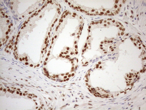 RGL2 Antibody - Immunohistochemical staining of paraffin-embedded Human prostate tissue using anti-RGL2 mouse monoclonal antibody. (Heat-induced epitope retrieval by 1mM EDTA in 10mM Tris buffer. (pH8.5) at 120°C for 3 min. (1:150)