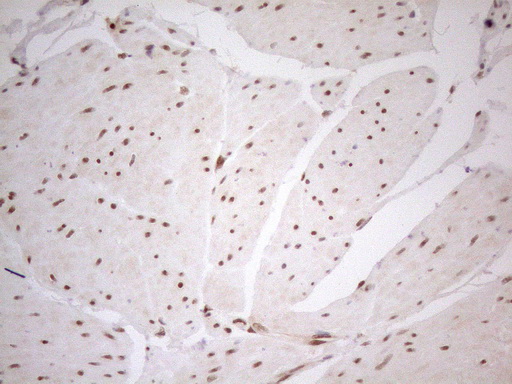 RGL2 Antibody - Immunohistochemical staining of paraffin-embedded Human bladder tissue using anti-RGL2 mouse monoclonal antibody. (Heat-induced epitope retrieval by 1mM EDTA in 10mM Tris buffer. (pH8.5) at 120°C for 3 min. (1:150)