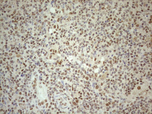 RGL2 Antibody - Immunohistochemical staining of paraffin-embedded Human lymph node tissue using anti-RGL2 mouse monoclonal antibody. (Heat-induced epitope retrieval by 1mM EDTA in 10mM Tris buffer. (pH8.5) at 120°C for 3 min. (1:150)