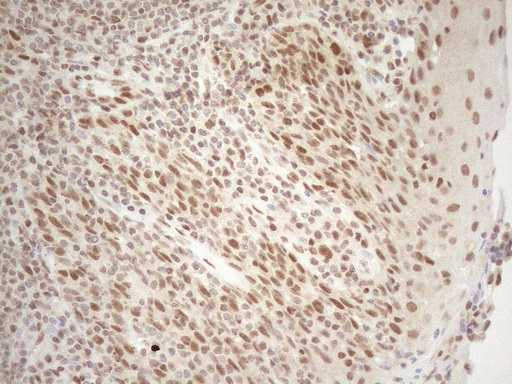 RGL2 Antibody - Immunohistochemical staining of paraffin-embedded Human tonsil using anti-RGL2 mouse monoclonal antibody. (Heat-induced epitope retrieval by 1mM EDTA in 10mM Tris buffer. (pH8.5) at 120°C for 3 min. (1:150)