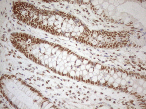 RGL2 Antibody - Immunohistochemical staining of paraffin-embedded Human colon tissue using anti-RGL2 mouse monoclonal antibody. (Heat-induced epitope retrieval by 1mM EDTA in 10mM Tris buffer. (pH8.5) at 120°C for 3 min. (1:150)