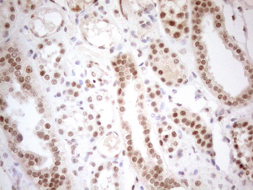 RGL2 Antibody - Immunohistochemical staining of paraffin-embedded Human Kidney tissue using anti-RGL2 mouse monoclonal antibody. (Heat-induced epitope retrieval by 1mM EDTA in 10mM Tris buffer. (pH8.5) at 120°C for 3 min. (1:150)