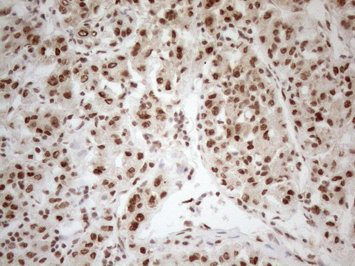 RGL2 Antibody - Immunohistochemical staining of paraffin-embedded Human liver tissue using anti-RGL2 mouse monoclonal antibody. (Heat-induced epitope retrieval by 1mM EDTA in 10mM Tris buffer. (pH8.5) at 120°C for 3 min. (1:150)
