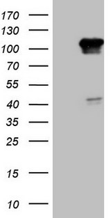 RGL2 Antibody - HEK293T cells were transfected with the pCMV6-ENTRY control. (Left lane) or pCMV6-ENTRY RGL2. (Right lane) cDNA for 48 hrs and lysed. Equivalent amounts of cell lysates. (5 ug per lane) were separated by SDS-PAGE and immunoblotted with anti-RGL2. (1:2000)