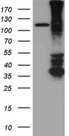 RGMA Antibody - HEK293T cells were transfected with the pCMV6-ENTRY control. (Left lane) or pCMV6-ENTRY RGMA. (Right lane) cDNA for 48 hrs and lysed. Equivalent amounts of cell lysates. (5 ug per lane) were separated by SDS-PAGE and immunoblotted with anti-RGMA. (1:2000)
