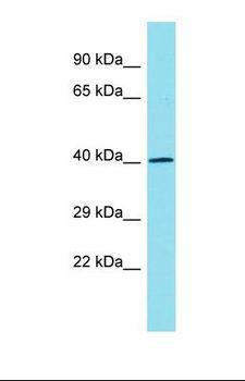 RGMA Antibody - Western blot of Mouse Heart. Rgma antibody dilution 1.0 ug/ml.  This image was taken for the unconjugated form of this product. Other forms have not been tested.