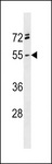 RGMA Antibody - RGMA Antibody western blot of NCI-H460 cell line lysates (35 ug/lane). The RGMA antibody detected the RGMA protein (arrow).