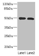 RGMA Antibody - Western Blot All lanes: GCDH antibody at 12µg/ml Lane 1: Mouse brain tissue Lane 2: Hela whole cell lysate Secondary Goat polyclonal to rabbit IgG at 1/10000 dilution Predicted band size: 50, 48, 51 kDa Observed band size: 50 kDa