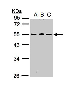 RGMB Antibody - Sample (30 ug whole cell lysate). A: A431, B: H1299, C: HeLa S3. 10% SDS PAGE. RGMB antibody diluted at 1:1000