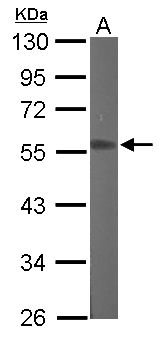RGMB Antibody - Sample (50 ug of whole cell lysate). A: Mouse brain. 10% SDS PAGE. RGMB antibody diluted at 1:1000.
