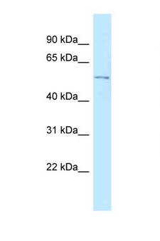 RGMB Antibody - RGMB antibody Western blot of HCT15 Cell lysate. Antibody concentration 1 ug/ml.  This image was taken for the unconjugated form of this product. Other forms have not been tested.
