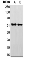 RGMB Antibody - Western blot analysis of RGMB expression in HEK293T (A); NIH3T3 (B); H9C2 (C) whole cell lysates.