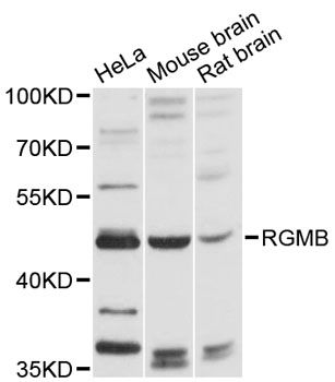 RGMB Antibody - Western blot analysis of extracts of various cell lines, using RGMB antibody at 1:3000 dilution. The secondary antibody used was an HRP Goat Anti-Rabbit IgG (H+L) at 1:10000 dilution. Lysates were loaded 25ug per lane and 3% nonfat dry milk in TBST was used for blocking. An ECL Kit was used for detection and the exposure time was 30s.