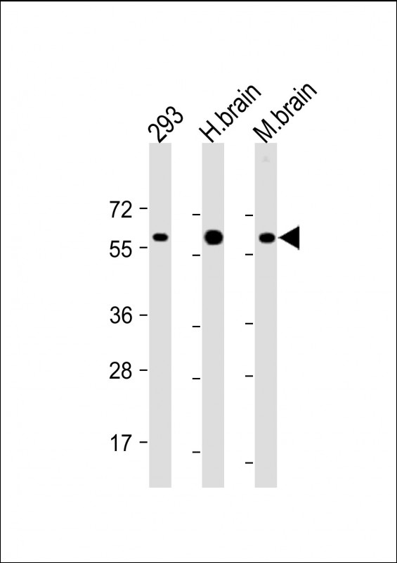 RGMB Antibody - All lanes: Anti-RGMB Antibody at 1:2000 dilution Lane 1: 293 whole cell lysate Lane 2: Human brain lysate Lane 3: Mouse brain lysate Lysates/proteins at 20 µg per lane. Secondary Goat Anti-Rabbit IgG, (H+L), Peroxidase conjugated at 1/10000 dilution. Predicted band size: 48 kDa Blocking/Dilution buffer: 5% NFDM/TBST.