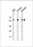 RGMB Antibody - All lanes: Anti-RGMB Antibody at 1:2000 dilution Lane 1: 293 whole cell lysate Lane 2: Human brain lysate Lane 3: Mouse brain lysate Lysates/proteins at 20 µg per lane. Secondary Goat Anti-Rabbit IgG, (H+L), Peroxidase conjugated at 1/10000 dilution. Predicted band size: 48 kDa Blocking/Dilution buffer: 5% NFDM/TBST.