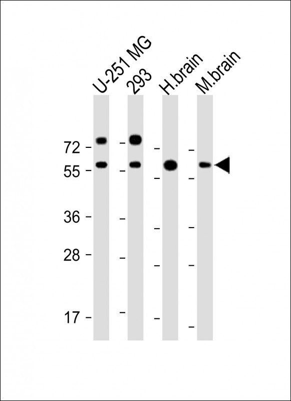 RGMB Antibody - All lanes: Anti-RGMB Antibody at 1:2000 dilution Lane 1: U-251 MG whole cell lysate Lane 2: 293 whole cell lysate Lane 3: Human brain lysate Lane 4: Mouse brain lysate Lysates/proteins at 20 µg per lane. Secondary Goat Anti-Rabbit IgG, (H+L), Peroxidase conjugated at 1/10000 dilution. Predicted band size: 48 kDa Blocking/Dilution buffer: 5% NFDM/TBST.