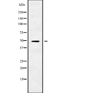 RGMB Antibody - Western blot analysis of RGMB using COLO205 whole cells lysates