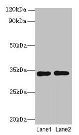 RGN / Regucalcin Antibody - Western blot All lanes: Rgn antibody at 8µg/ml Lane 1: A549 whole cell lysate Lane 2: HCT116 whole cell lysate Secondary Goat polyclonal to rabbit IgG at 1/10000 dilution Predicted band size: 33 kDa Observed band size: 33 kDa
