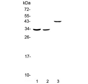 RGN / Regucalcin Antibody - Western blot testing of 1) rat liver, 2) mouse liver and 3) human SMMC-7721 lysate with Regucalcin antibody at 0.5ug/ml. Predicted molecular weight ~33 kDa.
