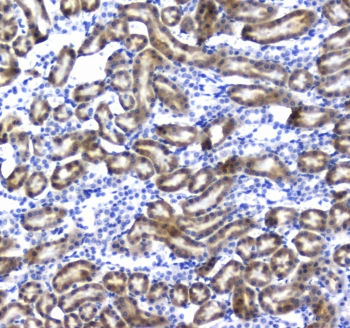 RGN / Regucalcin Antibody - IHC testing of FFPE rat kidney tissue with IRF7 antibody at 1ug/ml. Required HIER: steam section in pH6 citrate buffer for 20 min and allow to cool prior to staining.