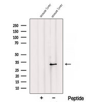 RGN / Regucalcin Antibody - Western blot analysis of extracts of mouse liver tissue using RGN/SMP30 antibody. The lane on the left was treated with blocking peptide.