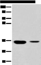 RGN / Regucalcin Antibody - Western blot analysis of Mouse liver tissue and Human fetal liver tissue lysates  using RGN Polyclonal Antibody at dilution of 1:500
