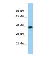 RGP1 Antibody - Western blot of Human HepG2. RGP1 antibody dilution 1.0 ug/ml.  This image was taken for the unconjugated form of this product. Other forms have not been tested.