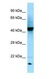 RGP1 Antibody - RGP1 antibody Western Blot of 721_B.  This image was taken for the unconjugated form of this product. Other forms have not been tested.