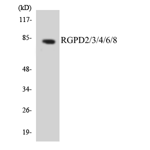 RGPD2+3+4+6+8 Antibody - Western blot analysis of the lysates from Jurkat cells using RGPD2/3/4/6/8 antibody.