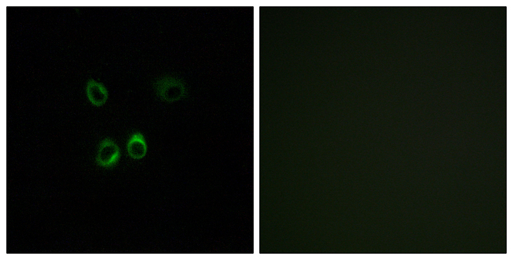 RGR Antibody - Immunofluorescence analysis of MCF7 cells, using RGR Antibody. The picture on the right is blocked with the synthesized peptide.
