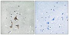 RGR Antibody - Immunohistochemistry analysis of paraffin-embedded human brain tissue, using RGR Antibody. The picture on the right is blocked with the synthesized peptide.
