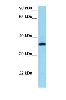 RGR Antibody - RGR antibody Western blot of PANC1 Cell lysate. Antibody concentration 1 ug/ml.  This image was taken for the unconjugated form of this product. Other forms have not been tested.