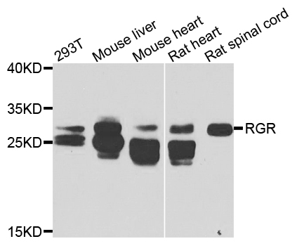 RGR Antibody - Western blot analysis of extracts of various cells.
