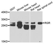 RGR Antibody - Western blot analysis of extracts of various cells.