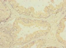 RGR Antibody - Immunohistochemistry of paraffin-embedded human prostate tissue at dilution 1:100