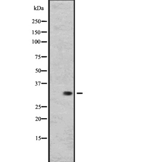 RGR Antibody - ACHN whole cells lysate