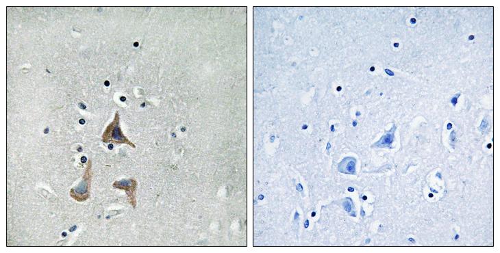 RGR Antibody - Peptide - + Immunohistochemistry analysis of paraffin-embedded human brain tissue using RGR antibody.