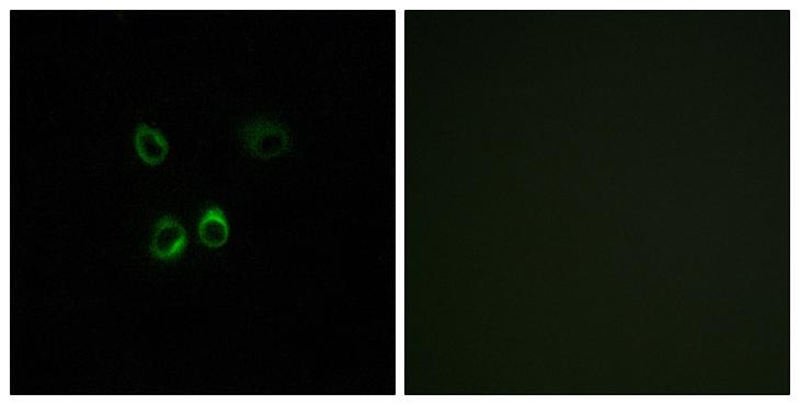 RGR Antibody - Peptide - + Immunofluorescence analysis of MCF-7 cells, using RGR antibody.
