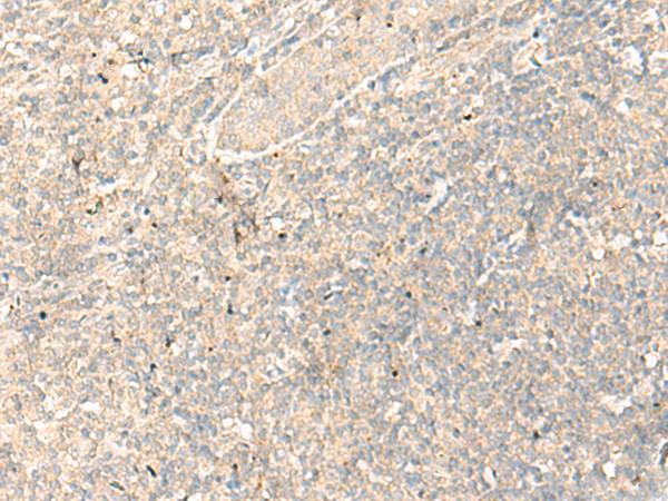 RGR Antibody - Immunohistochemistry of paraffin-embedded Human tonsil tissue  using RGR Polyclonal Antibody at dilution of 1:25(×200)