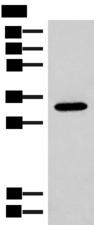 RGR Antibody - Western blot analysis of Mouse liver tissue lysate  using RGR Polyclonal Antibody at dilution of 1:300