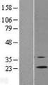 RGR Protein - Western validation with an anti-DDK antibody * L: Control HEK293 lysate R: Over-expression lysate