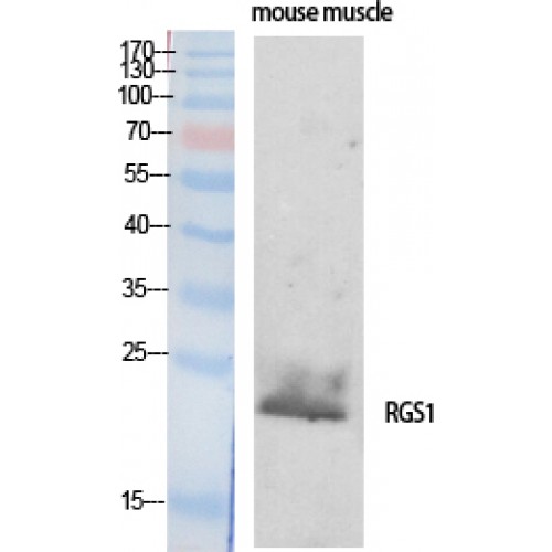 RGS1 Antibody - Western blot of RGS1 antibody