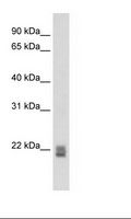 RGS1 Antibody - SP2/0 Cell Lysate.  This image was taken for the unconjugated form of this product. Other forms have not been tested.