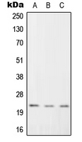 RGS1 Antibody - Western blot analysis of RGS1 expression in K562 (A); Raw264.7 (B); H9C2 (C) whole cell lysates.