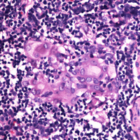 RGS1 Antibody - Immunohistochemical analysis of RGS1 staining in human thymus formalin fixed paraffin embedded tissue section. The section was pre-treated using heat mediated antigen retrieval with sodium citrate buffer (pH 6.0). The section was then incubated with the antibody at room temperature and detected using an HRP conjugated compact polymer system. DAB was used as the chromogen. The section was then counterstained with hematoxylin and mounted with DPX.