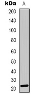 RGS1 Antibody - Western blot analysis of RGS1 expression in NIH3T3 (A) whole cell lysates.