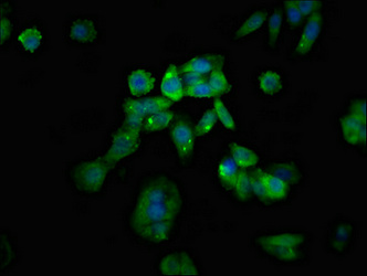 RGS1 Antibody - Immunofluorescent analysis of HepG2 cells at a dilution of 1:100 and Alexa Fluor 488-congugated AffiniPure Goat Anti-Rabbit IgG(H+L)